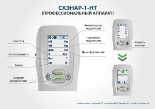СКЭНАР-1-НТ (исполнение 01)  в Черкесске купить Медицинская техника - denasosteo.ru 